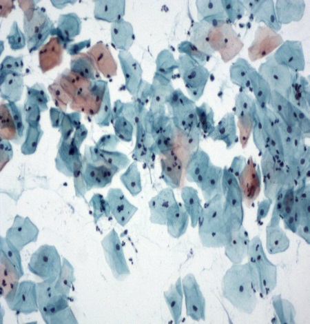 Citopatologia