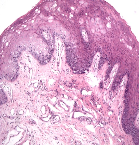 Anatomia Patológica